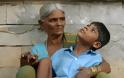 ΣΟΚ στην Ινδία! Παιδί με σοβαρά κινητικά προβλήματα βρέθηκε αλυσοδεμένο για να μην... φύγει! [photos] - Φωτογραφία 4