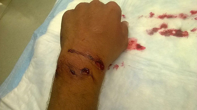 ΗΠΑ: Έτσι πήγε να βγάλει αλιγάτορα από το δρόμο και κατέληξε στο νοσοκομείο! - Προσοχή, σκληρές εικόνες - Φωτογραφία 12