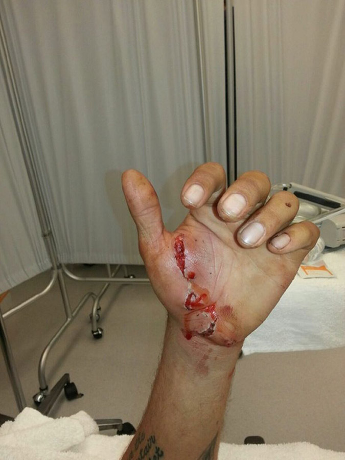 ΗΠΑ: Έτσι πήγε να βγάλει αλιγάτορα από το δρόμο και κατέληξε στο νοσοκομείο! - Προσοχή, σκληρές εικόνες - Φωτογραφία 9