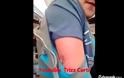 Πανικός στο μετρό του Λονδίνου: Γυναίκα με τον σύνδρομο Σουάρες δαγκώνει επιβάτη! [video]
