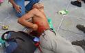 Αίμα και δάκρυα στην Κόστα Ρίκα - Μαχαίρωσαν τρεις φιλάθλους μετά από τον αποκλεισμό από το Μουντιάλ - Φωτογραφία 9