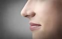 Η γυναίκα που εμφάνισε... μύτη στην πλάτη μετά από θεραπεία με βλαστοκύτταρα