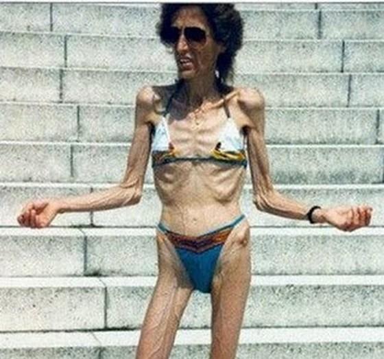 ΔΕΙΤΕ: Πώς καταντάνε οι γυναίκες bodybuilder όταν γεράσουν!!! - Φωτογραφία 3