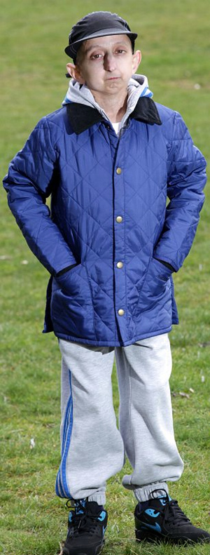 Στα είκοσι του έχει σώμα... 160 ετών! - Φωτογραφία 3