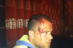 Αλβανικές προκλήσεις με στόχο την μειονότητα -Νέα επεισόδια σε βάρος της ομογένειας στην Χειμάρρα