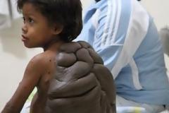 ΦΩΤΟ: Νέα ζωή για το αγόρι – χελώνα