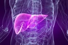 Οι καλοήθεις όγκοι του ήπατος επηρεάζουν κυρίως τις γυναίκες. Πόσο επικίνδυνοι είναι και πώς αντιμετωπίζονται;