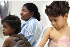 Έγινε καλά το «αγόρι- χελώνα»!