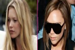 Celebrities με χάλια επιδερμίδα (Photos)