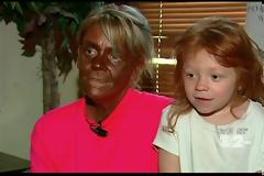 Έγινε... μαύρη από το σολάριουμ