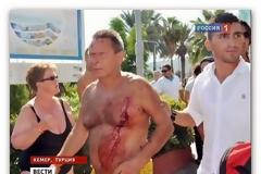 ΣΟΚΑΡΙΣΤΙΚΟ: Ρώσοι και Ουκρανοί πιάστηκαν στα χέρια στη Τουρκία...Αποτέλεσμα,ένας νεκρός... [photos]