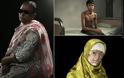 Συγκλονιστικό: Οι άνθρωποι που γλύτωσαν από επιθέσεις με οξύ [photos]