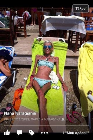 Εικόνες της Νανάς Καραγιάννη στη παραλία που σοκάρουν [photos] - Φωτογραφία 4
