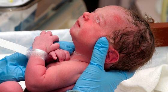 Μοναδικές εικόνες από νεογέννητα μωρά λίγα λεπτά αφού γεννήθηκαν - Φωτογραφία 12