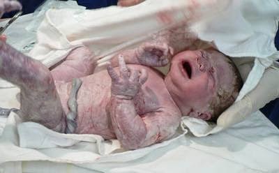 Μοναδικές εικόνες από νεογέννητα μωρά λίγα λεπτά αφού γεννήθηκαν - Φωτογραφία 13