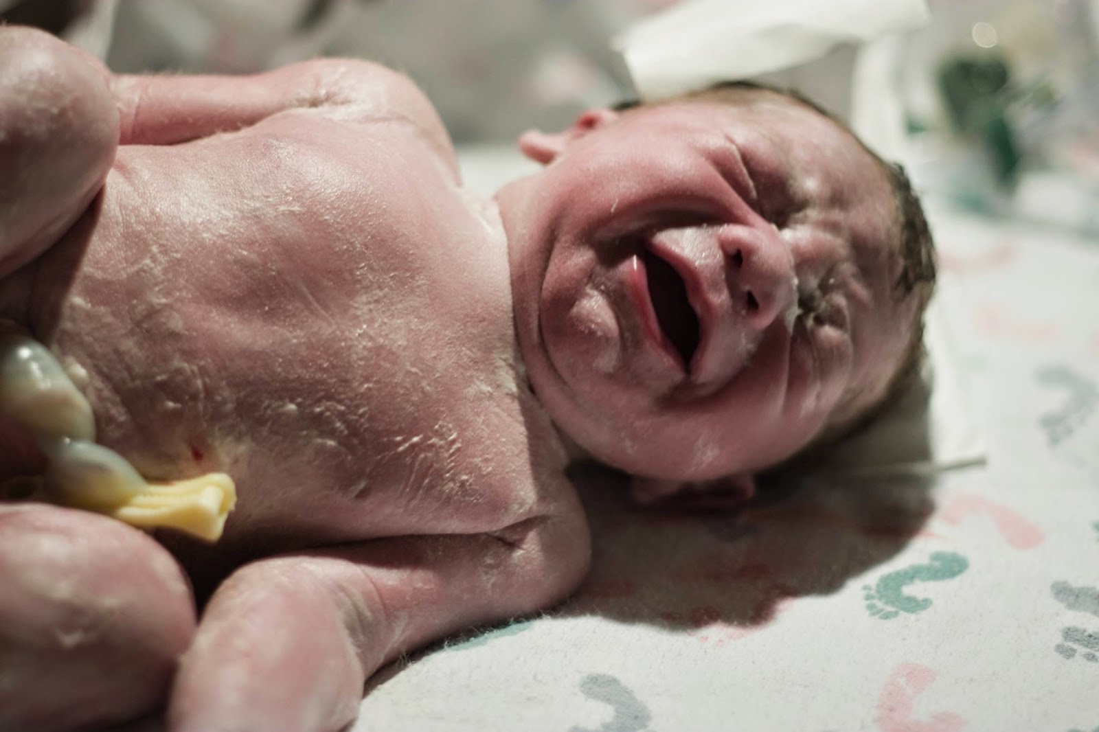 Μοναδικές εικόνες από νεογέννητα μωρά λίγα λεπτά αφού γεννήθηκαν - Φωτογραφία 7