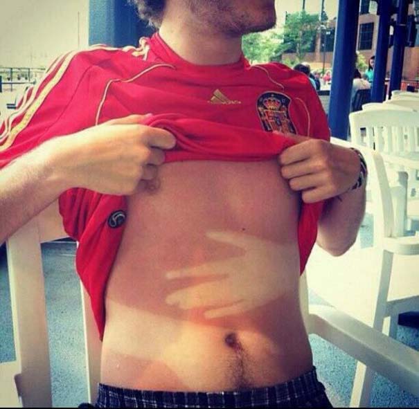 Δείτε τους ανθρώπους που κάτι δεν υπολόγισαν σωστά στο μαύρισμα τους… Πολύ γέλιο! [photos] - Φωτογραφία 16