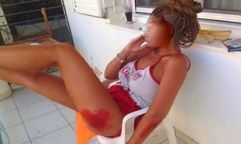 Στο νοσοκομείο μετά από επίθεση γνωστή Ελληνίδα τραγουδίστρια... [photo] - Φωτογραφία 2