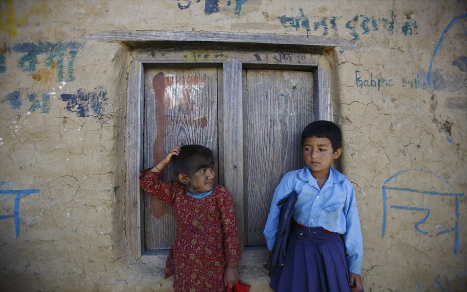 ΣΥΓΚΛΟΙΣΤΙΚΗ ΙΣΤΟΡΙΑ: Μία οικογένεια στο Νεπάλ πάσχει από το σύνδρομο του λυκάνθρωπου [photos] - Φωτογραφία 8