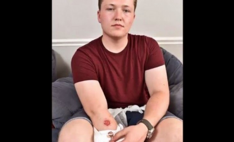 Δείτε τι έπαθε επειδή αποκοιμήθηκε πάνω στο κινητό του! - Φωτογραφία 2