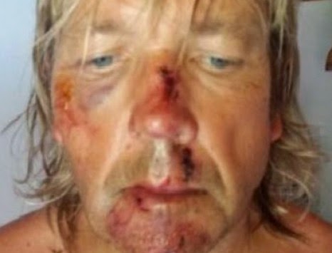 Άγγλος ποδηλάτης τραυματίστηκε στη Σκιάθο  - Ο εφιάλτης του τουρίστα και η επιστολή του! - Φωτογραφία 1