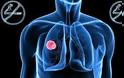 Να τι πρέπει να κάνετε για να μην πάθετε ποτέ καρκίνο του πνεύμονα