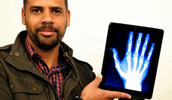 Αυστραλός εμφυτεύει στο χέρι του ένα μικροτσίπ NFC - Φωτογραφία 1