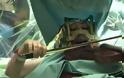 Μουσικός χειρουργήθηκε στον εγκέφαλο ενώ ήταν ξύπνια και έπαιζε βιολί [βίντεο