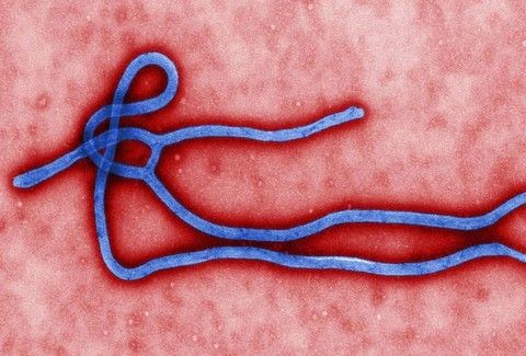 ΠΑΝΙΚΟΣ στις ΗΠΑ! Βρέθηκε ασθενής που έχει προσβληθεί από τον θανατηφόρο ιό Έμπολα - Φωτογραφία 1