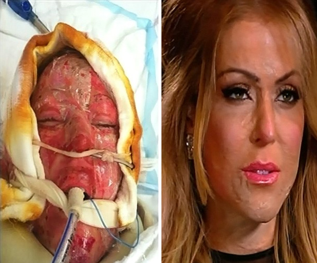 Η γυναίκα «χωρίς πρόσωπο» έβγαλε τη μάσκα - Φωτογραφία 2