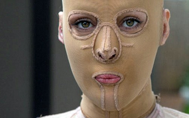 Η γυναίκα «χωρίς πρόσωπο» έβγαλε τη μάσκα - Φωτογραφία 7