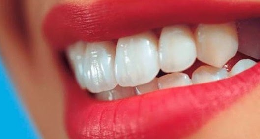 Μυστικά για λευκά δόντια που δε φαντάζεσαι! - Φωτογραφία 1