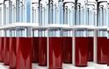Τεστ αίματος θα προβλέπει τον κίνδυνο σχιζοφρένειας;