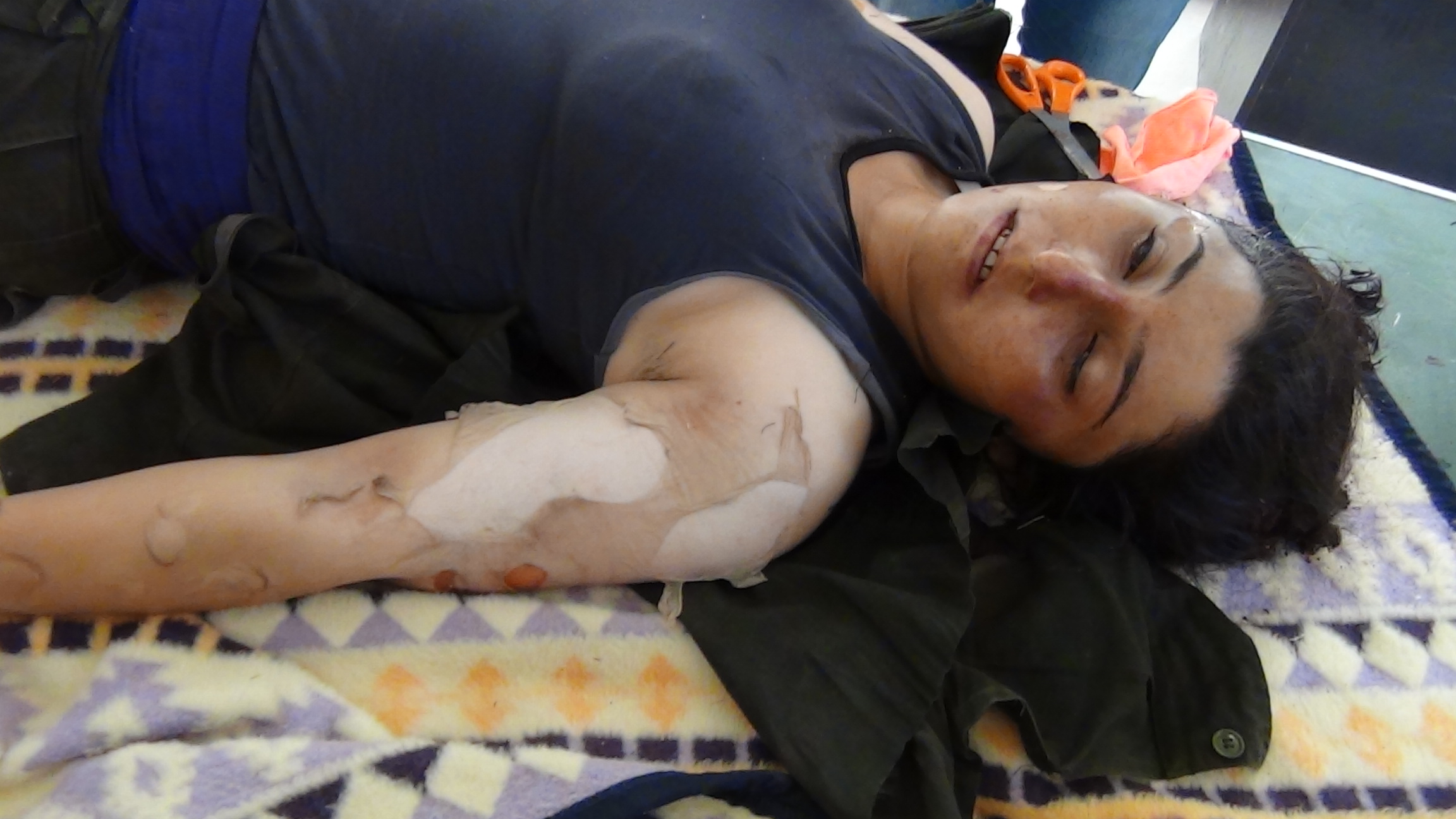 MERIA Special Report: Did ISIS Use Chemical Weapons Against the Kurds in Kobani? - Φωτογραφία 8