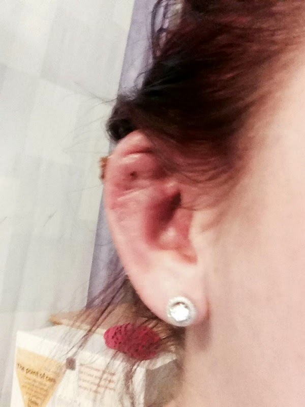 ΣΟΚΑΡΙΣΤΙΚΟ: 18χρονη έχασε μέρος τους αυτιού της χάρη στο... piercing [ΠΡΟΣΟΧΗ ΣΚΛΗΡΕΣ ΕΙΚΟΝΕΣ] - Φωτογραφία 3