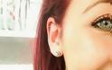 ΣΟΚΑΡΙΣΤΙΚΟ: 18χρονη έχασε μέρος τους αυτιού της χάρη στο... piercing [ΠΡΟΣΟΧΗ ΣΚΛΗΡΕΣ ΕΙΚΟΝΕΣ]