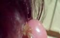 ΣΟΚΑΡΙΣΤΙΚΟ: 18χρονη έχασε μέρος τους αυτιού της χάρη στο... piercing [ΠΡΟΣΟΧΗ ΣΚΛΗΡΕΣ ΕΙΚΟΝΕΣ] - Φωτογραφία 4
