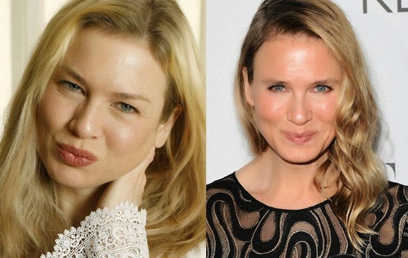 Ρενέ Ζελβέγκερ: Μα τι έκανε στο πρόσωπό της; - Φωτογραφία 2