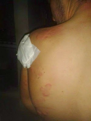 Έκαναν χρήση χημικών οι τζιχαντιστές κατά αμάχων στο Κομπάνι; Φωτογραφίες που προκαλούν τρόμο - Φωτογραφία 5