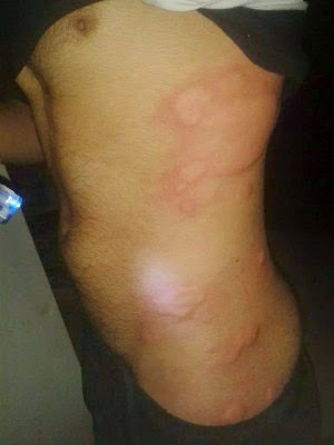 Έκαναν χρήση χημικών οι τζιχαντιστές κατά αμάχων στο Κομπάνι; Φωτογραφίες που προκαλούν τρόμο - Φωτογραφία 6