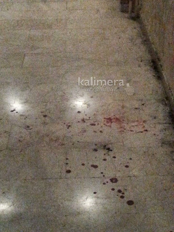 Κηλίδες αίματος στην είσοδο του κτιρίου που βρέθηκε νεκρός ο Θοδωρής Παπαναστασίου [photos] - Φωτογραφία 3