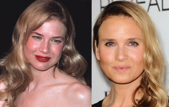 O πραγματικός λόγος για τον οποίο η Renee Zellweger άλλαξε πρόσωπο, μάλλον θα σας σοκάρει - Φωτογραφία 2