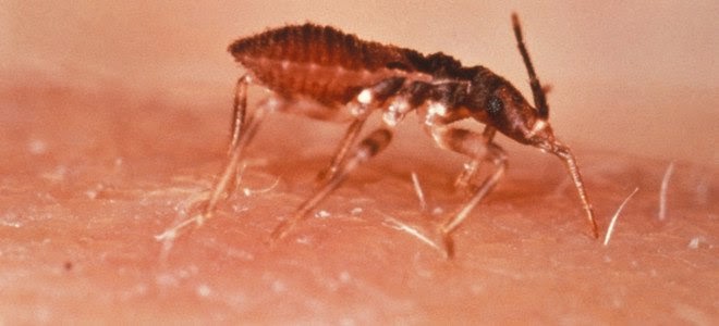 Νέα επιδημία στις ΗΠΑ μετά τον Εμπολα: Chagas ή «σιωπηλός δολοφόνος» - Φωτογραφία 1