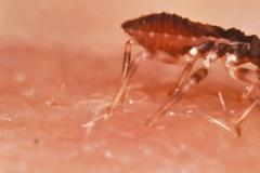 Νέα επιδημία στις ΗΠΑ μετά τον Εμπολα: Chagas ή «σιωπηλός δολοφόνος»