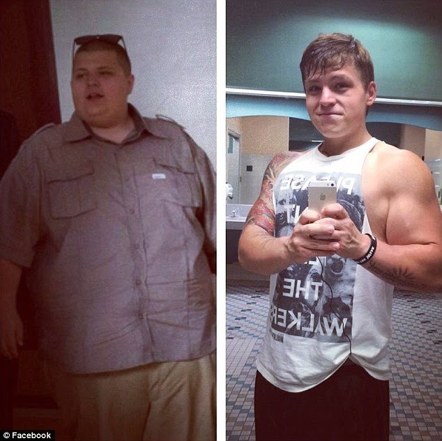 ΣΟΚΑΡΙΣΤΙΚΟ: Ένας 21χρονος έχασε 72 κιλά και το δέρμα του έγινε απίστευτα χαλαρό [photos] - Φωτογραφία 2