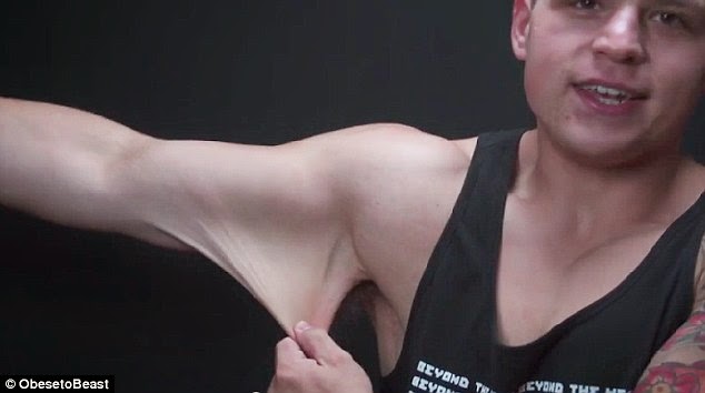 ΣΟΚΑΡΙΣΤΙΚΟ: Ένας 21χρονος έχασε 72 κιλά και το δέρμα του έγινε απίστευτα χαλαρό [photos] - Φωτογραφία 4