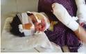 Μαρόκο: Χαράκωσε με ξυράφι 17χρονη ο πρώην βιαστής της και νυν σύζυγος! [photo] - Φωτογραφία 2