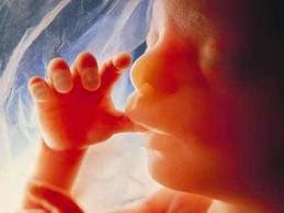ΣΥΓΚΛΟΝΙΣΤΙΚΟ ΒΙΝΤΕΟ:  H κραυγή απελπισίας ενός εμβρύου... [video] - Φωτογραφία 1