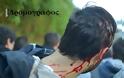 Δύο φοιτητές τραυματίες από επίθεση ανδρών της ΕΛ.ΑΣ. - Επεισόδια στο ΕΚΠΑ [photos] - Φωτογραφία 3