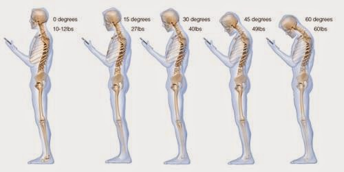 Πώς η αποστολή μηνυμάτων από το κινητό καταστρέφει τη σπονδυλική στήλη [εικόνα] - Φωτογραφία 2